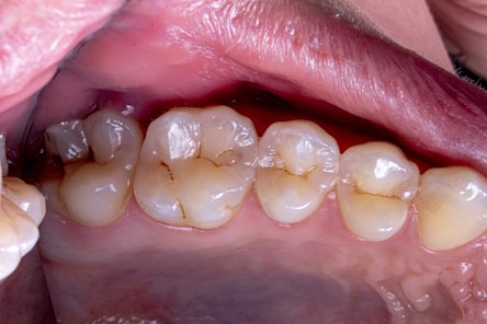 close-up of a person's mouth