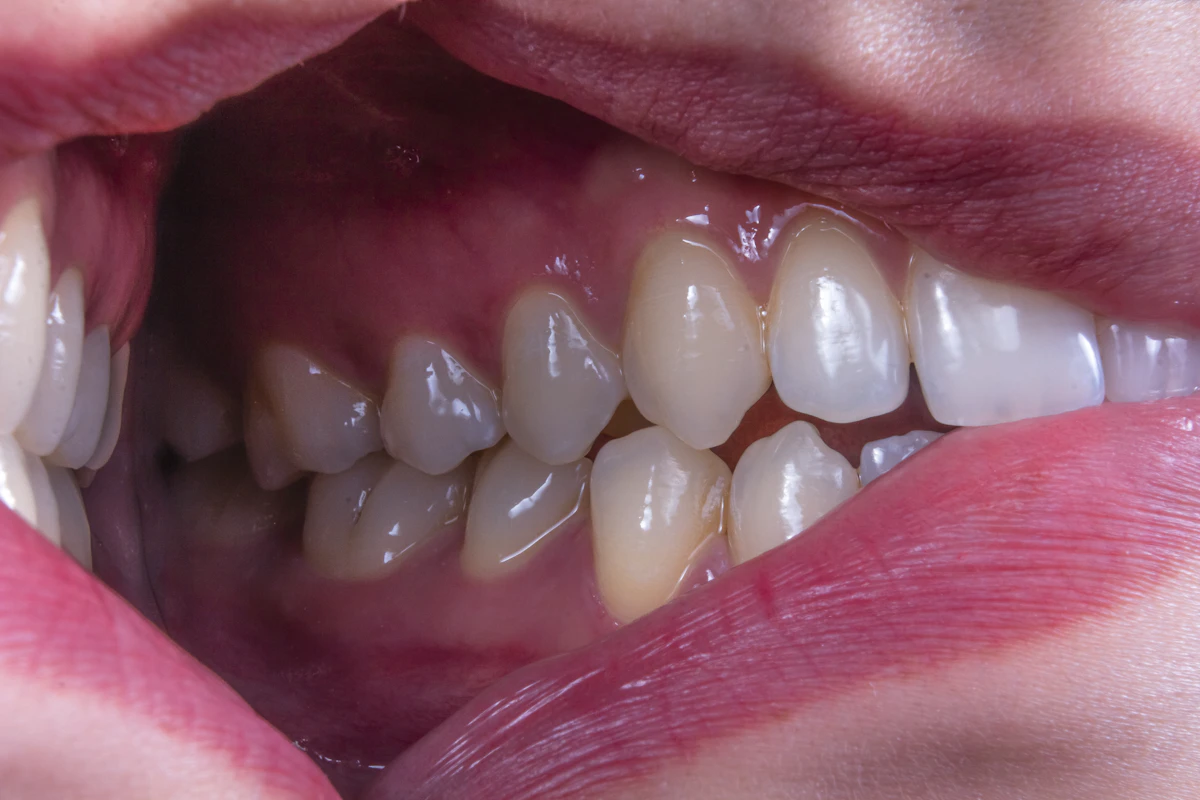 İllüstratif görsel: a person's mouth with teeth showing