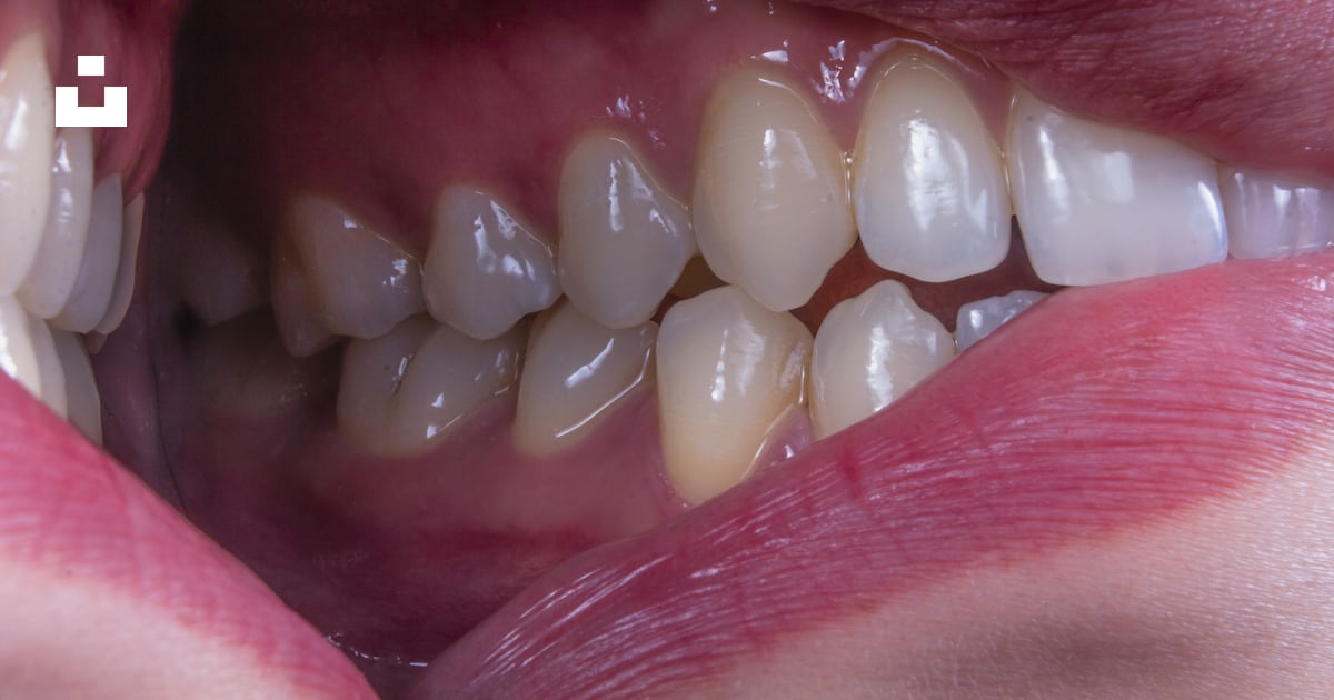 Dental Implant Sunbury OH