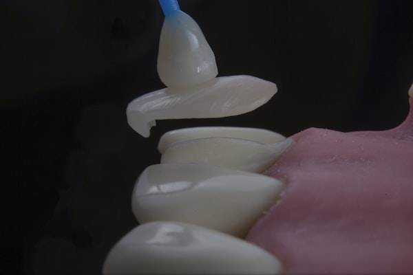 Стоматологические коронки и виниры