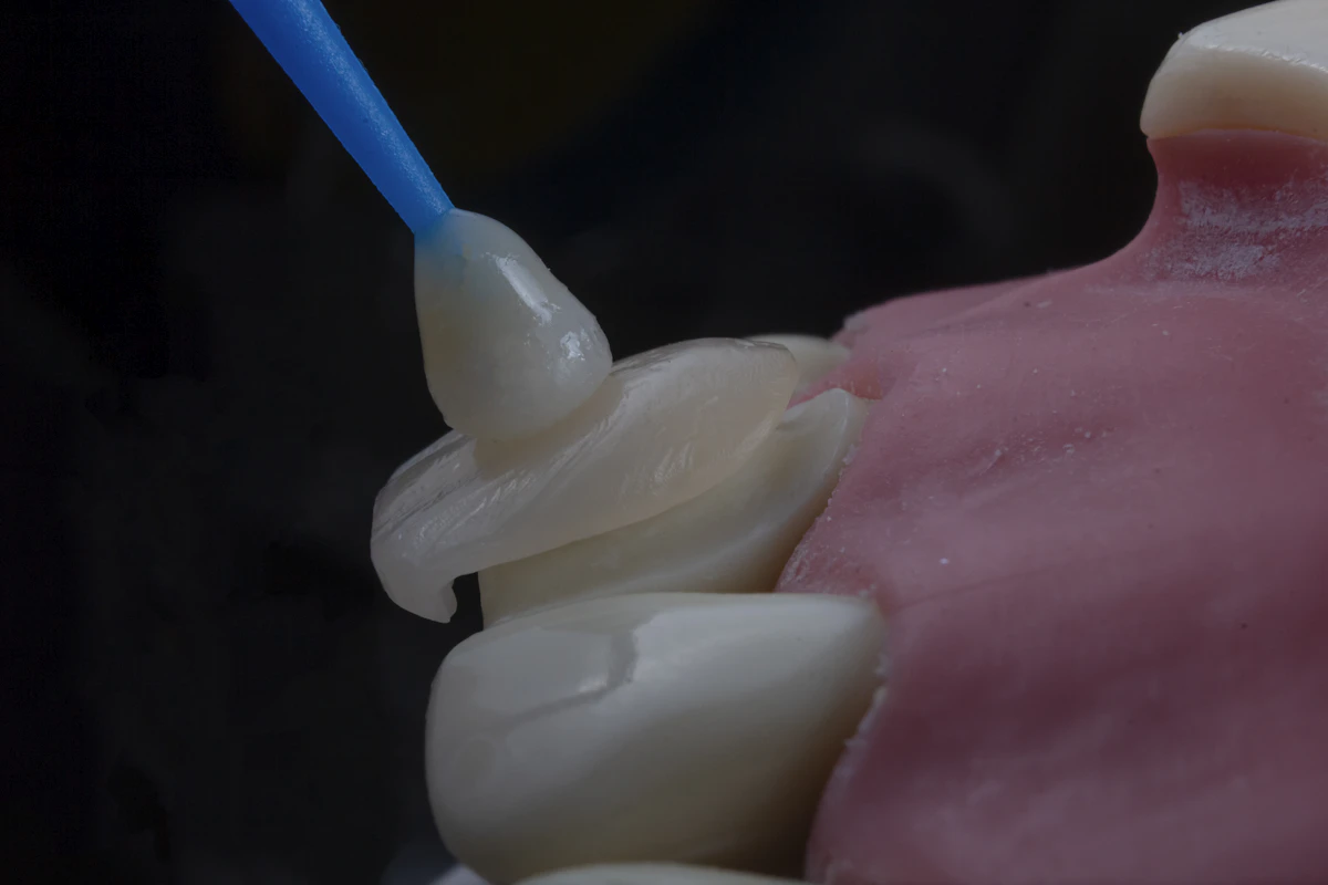 İllüstratif görsel: a close-up of a toothbrush