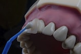A dental model displaying human teeth and gums is being used to demonstrate veneer application. A dental instrument is holding a veneer up to one of the front teeth.
