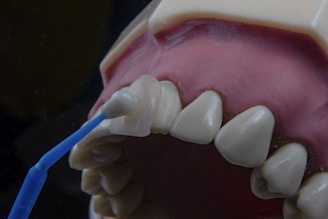 A dental model displaying human teeth and gums is being used to demonstrate veneer application. A dental instrument is holding a veneer up to one of the front teeth.