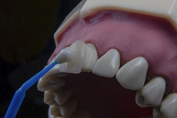A dental model displaying human teeth and gums is being used to demonstrate veneer application. A dental instrument is holding a veneer up to one of the front teeth.