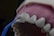 A dental model displaying human teeth and gums is being used to demonstrate veneer application. A dental instrument is holding a veneer up to one of the front teeth.