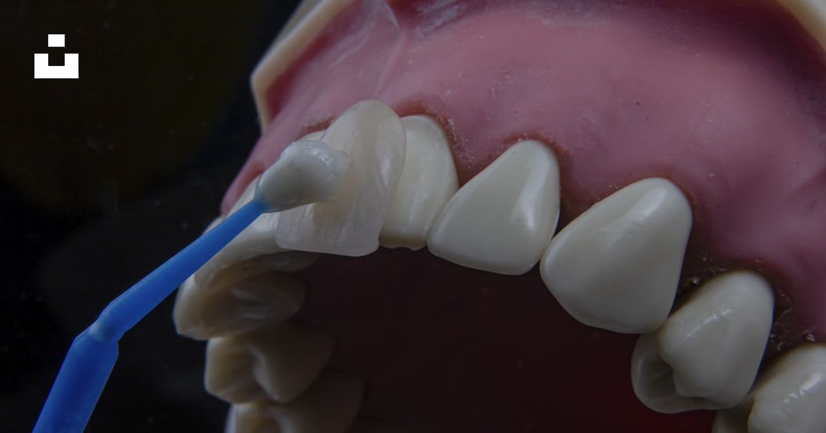 Dental Implant Hartford OH