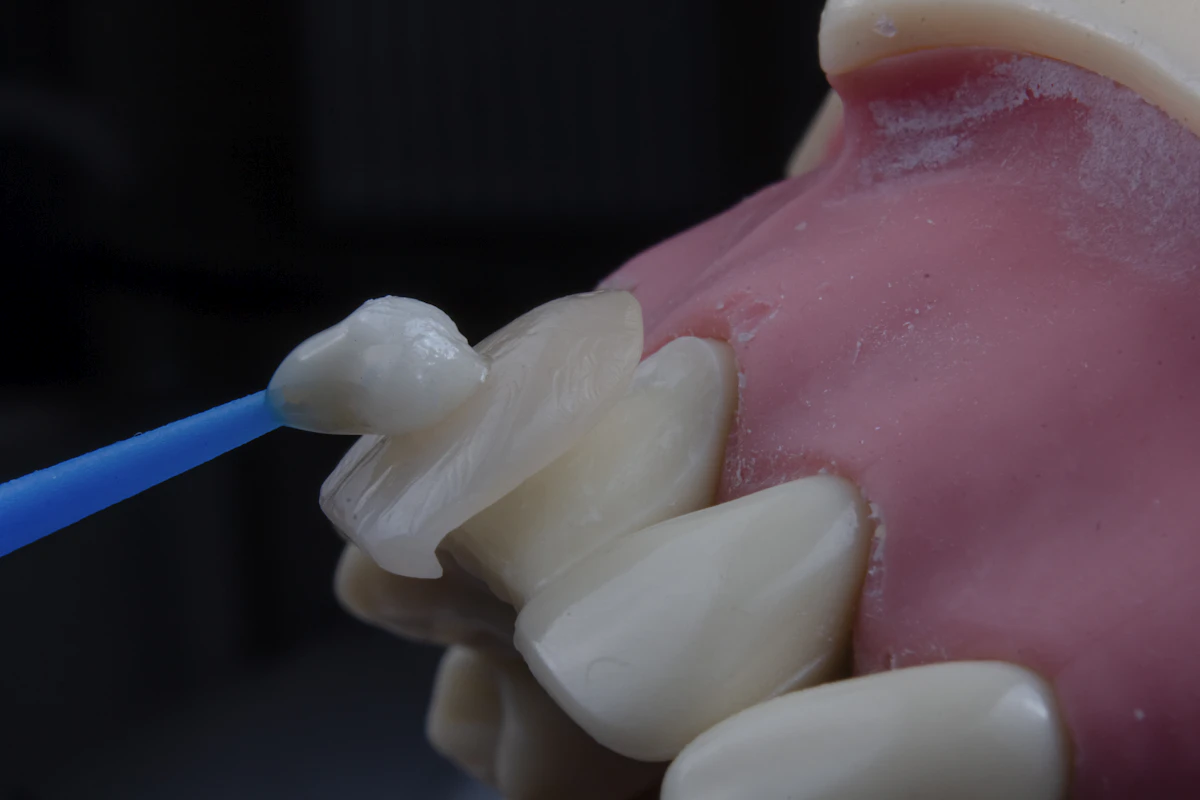 İllüstratif görsel: a close-up of a toothbrush
