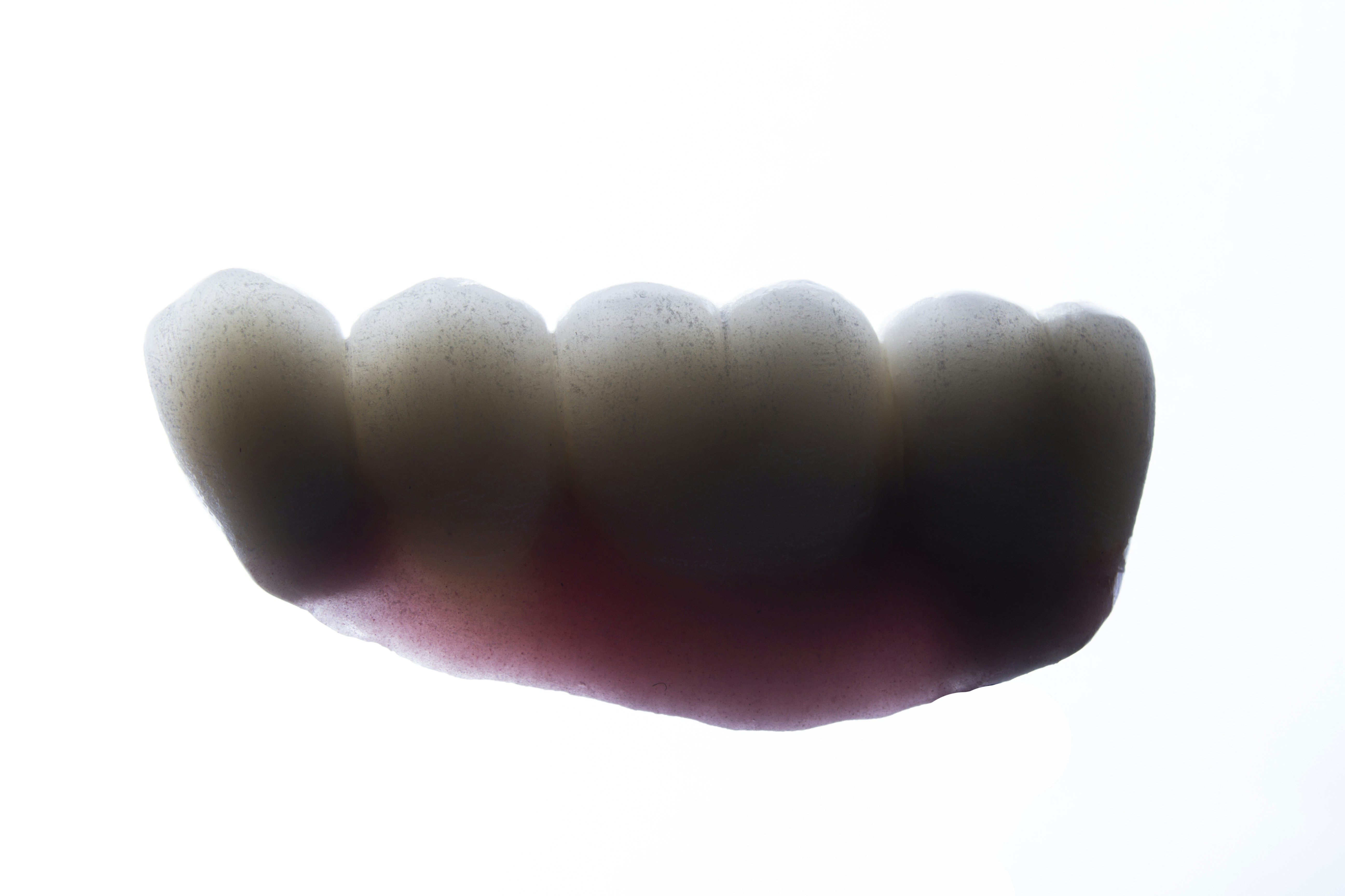 Photo by dentistozkanguner