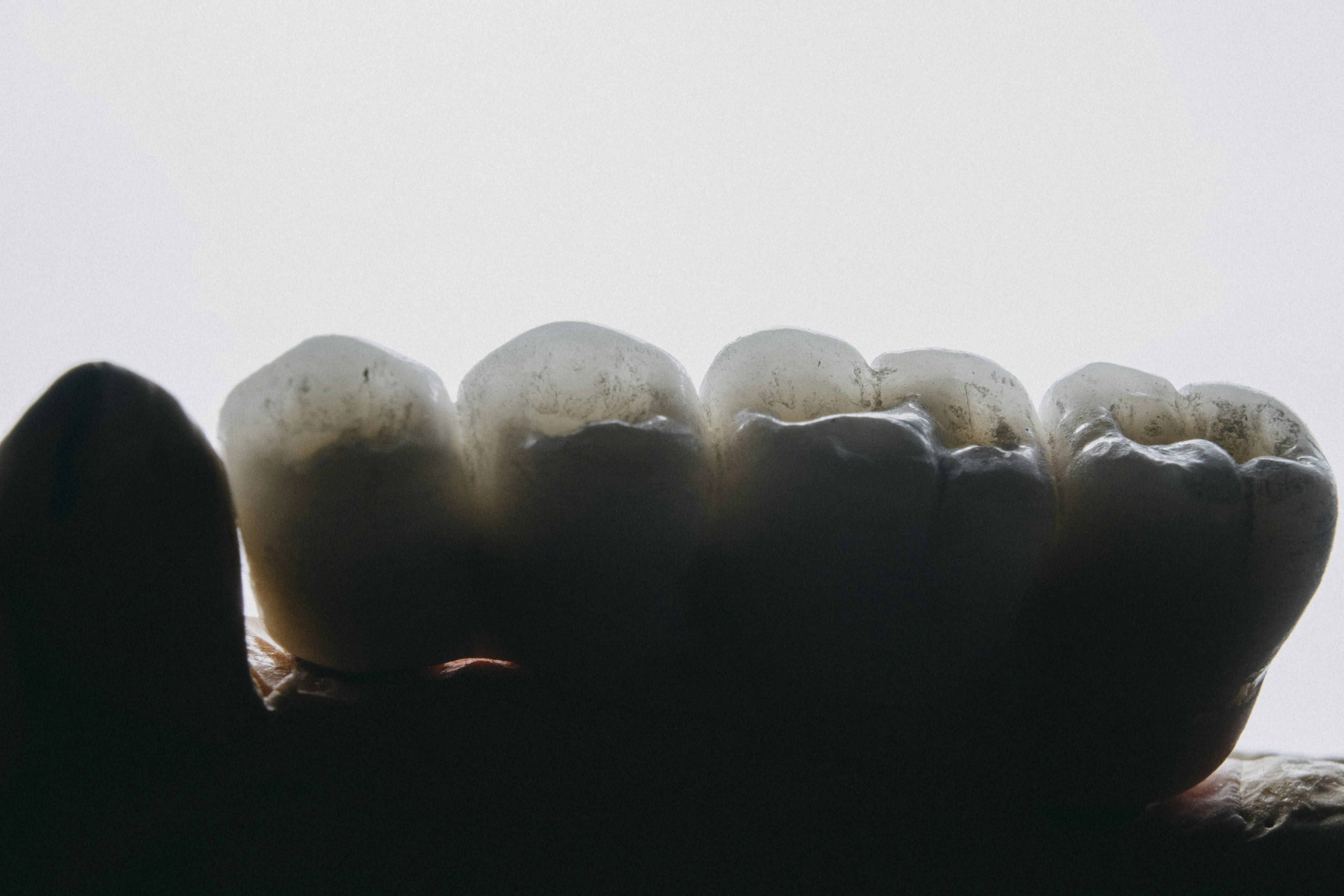 Dental Implant Columbus OH