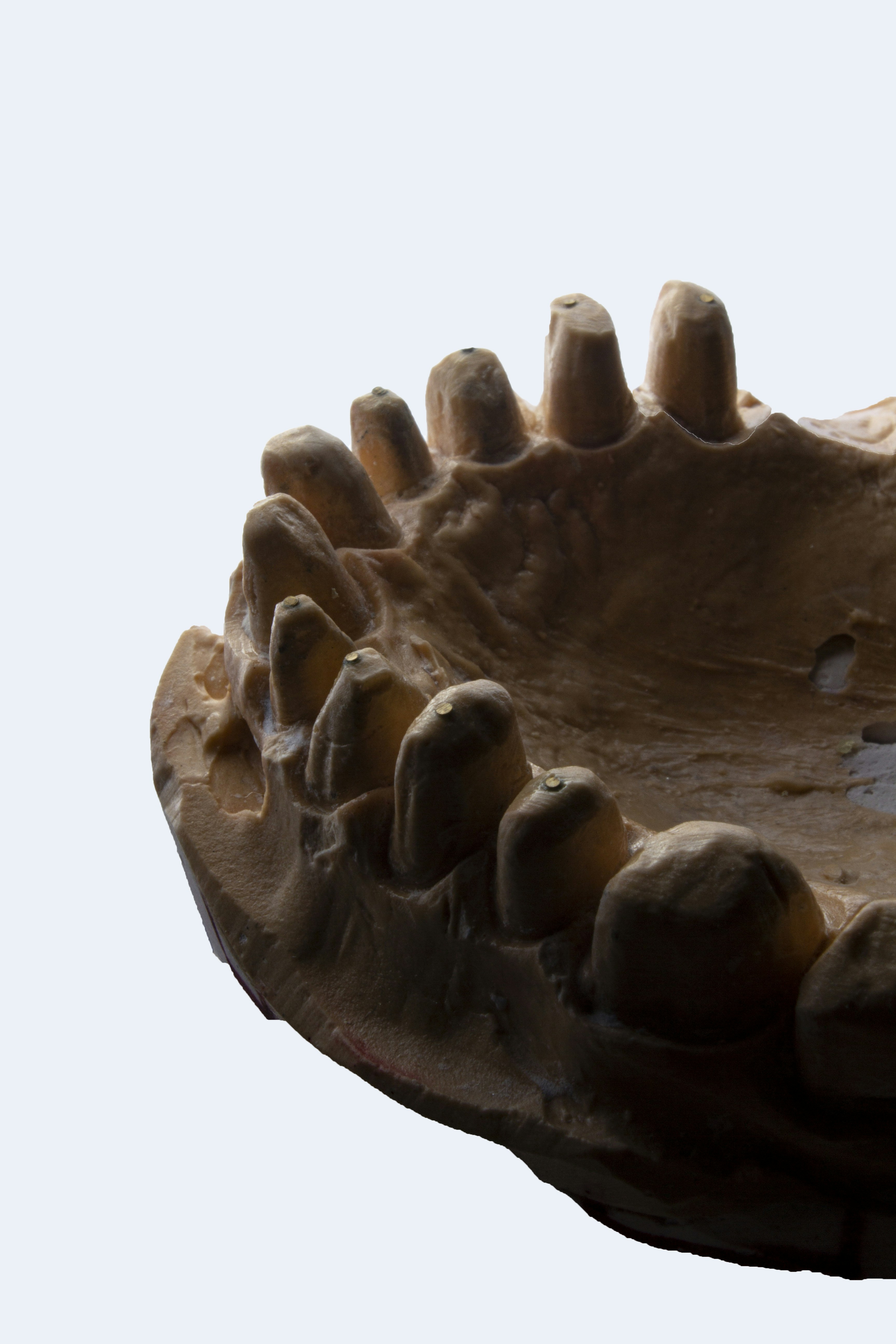 Photo by dentistozkanguner