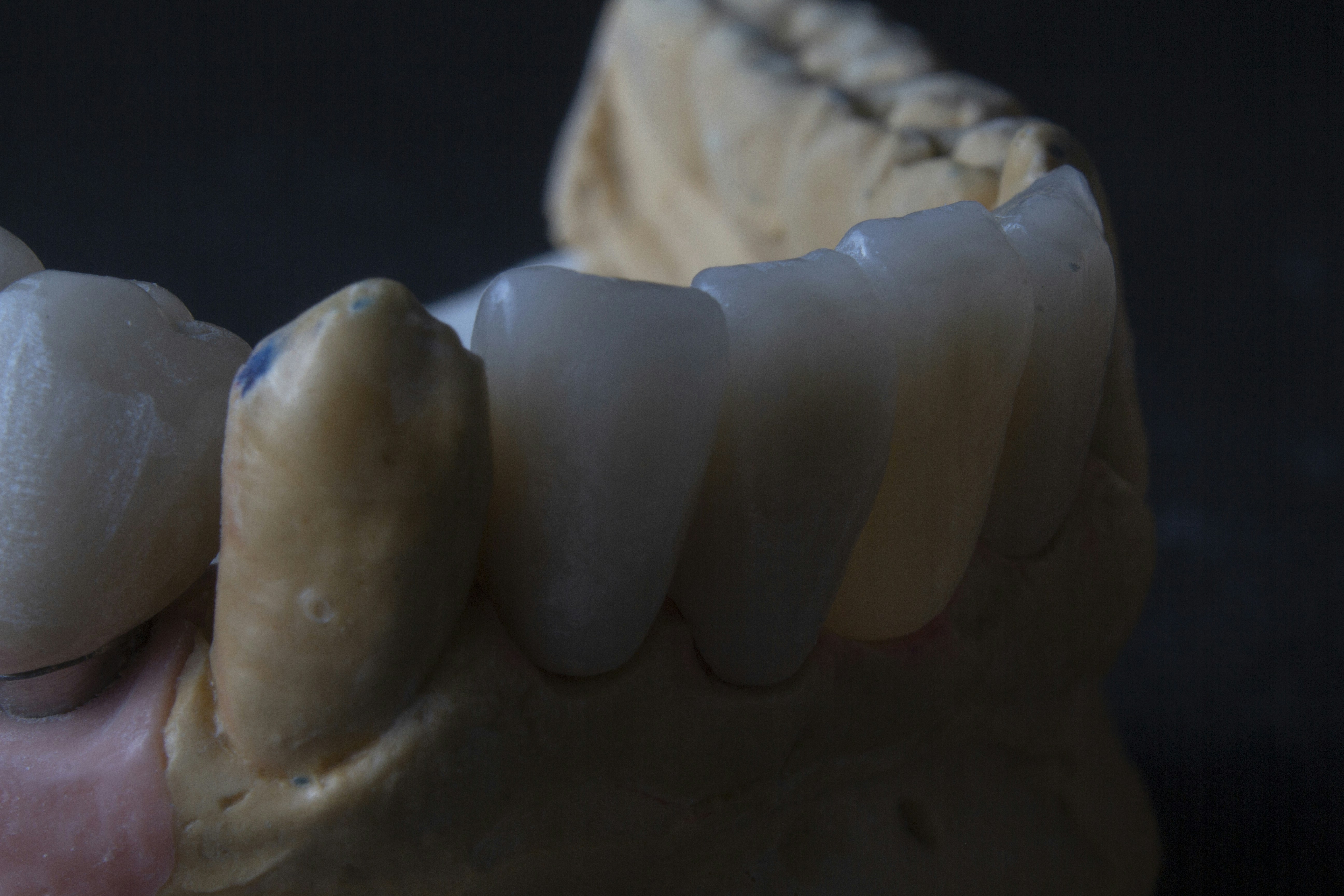 Photo by dentistozkanguner