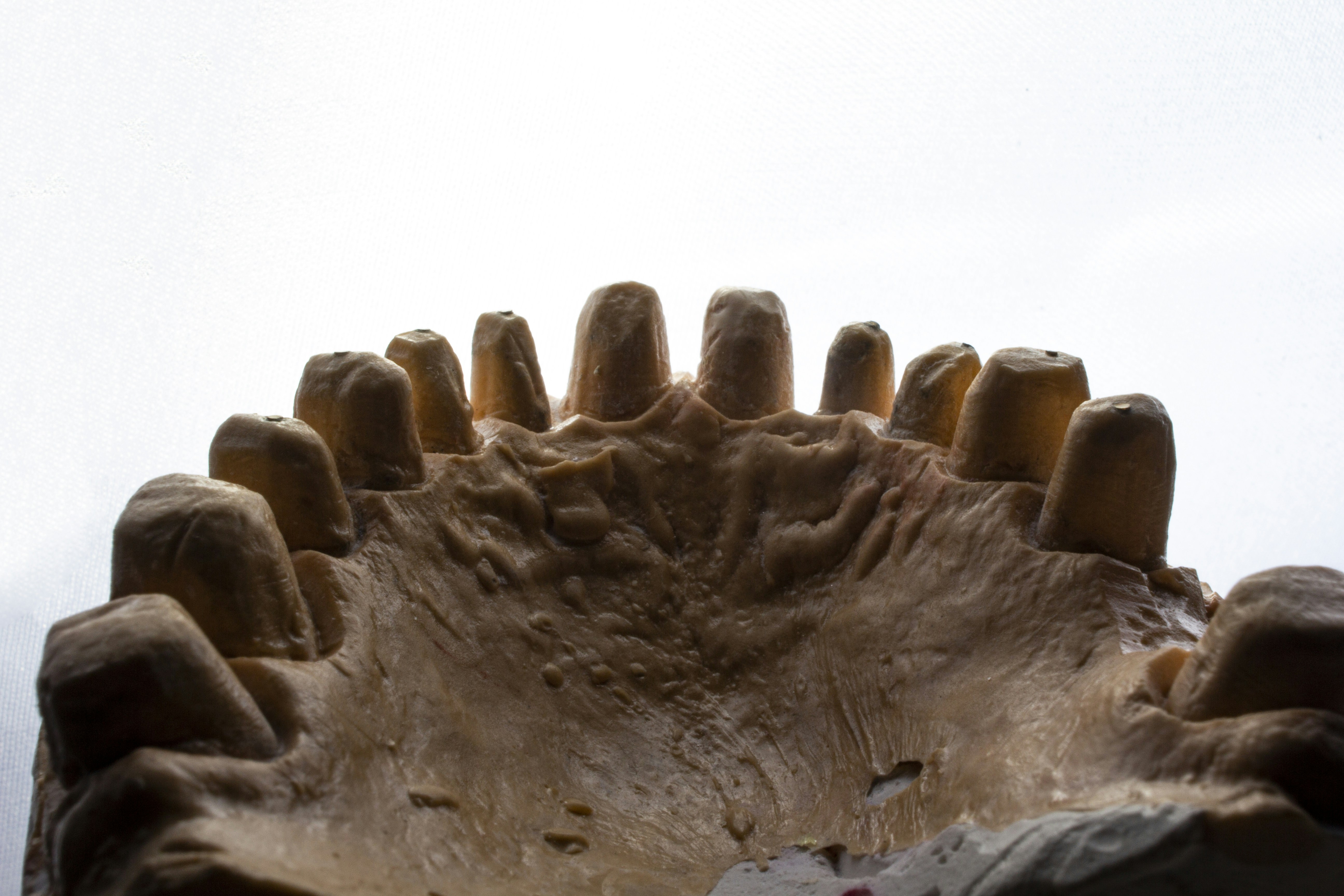 Photo by dentistozkanguner