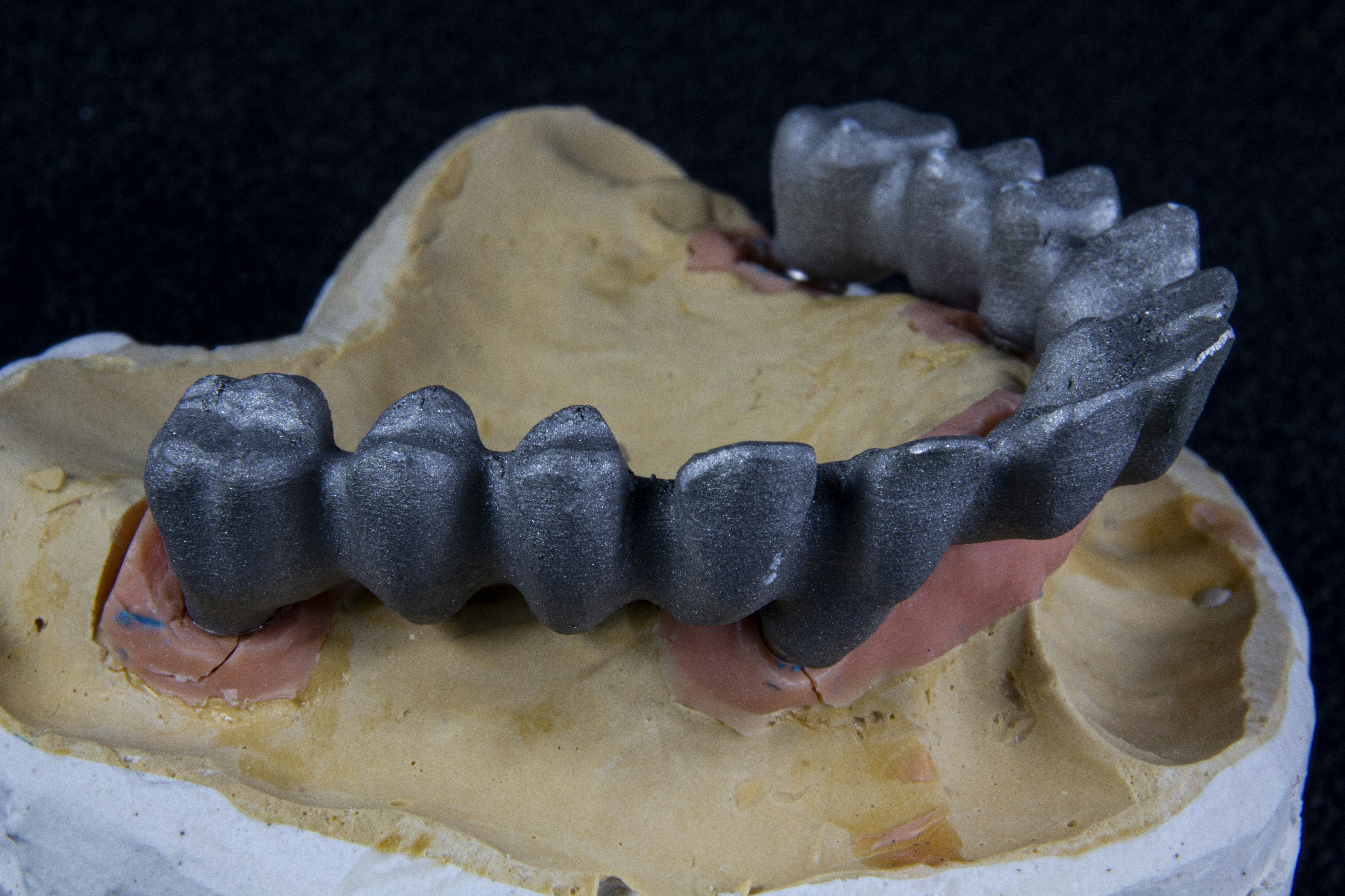 Photo by dentistozkanguner