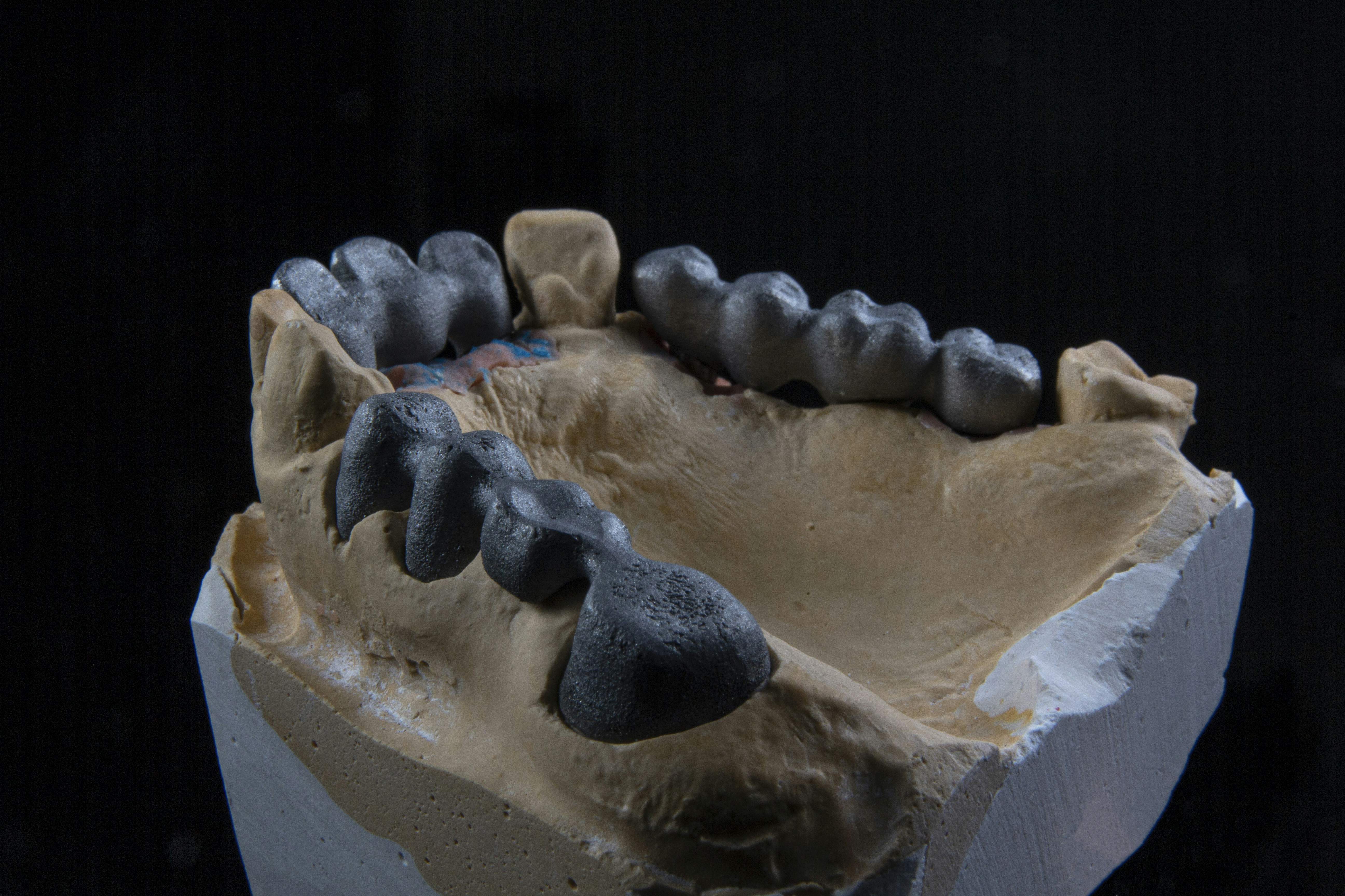 Photo by dentistozkanguner