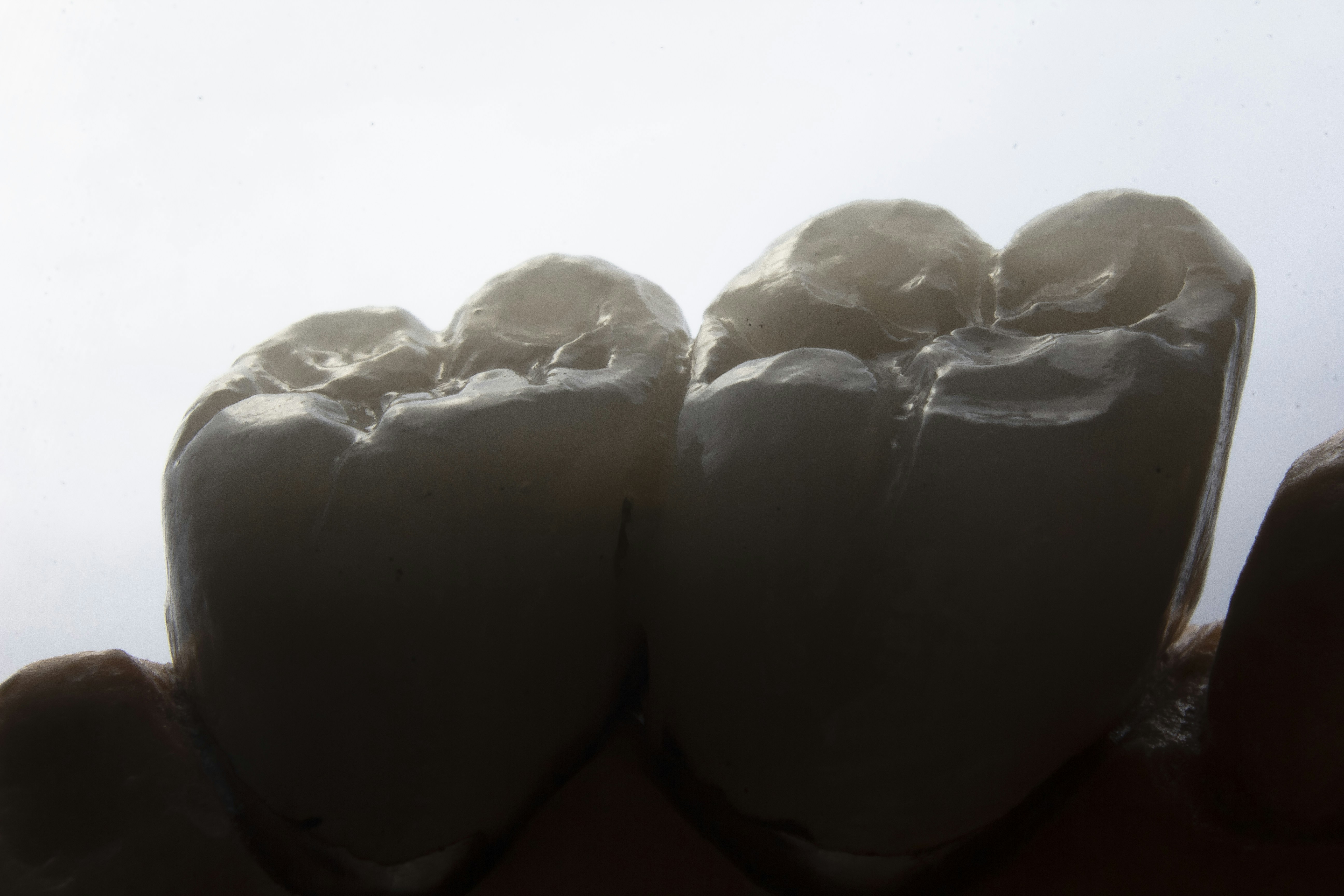 Photo by dentistozkanguner