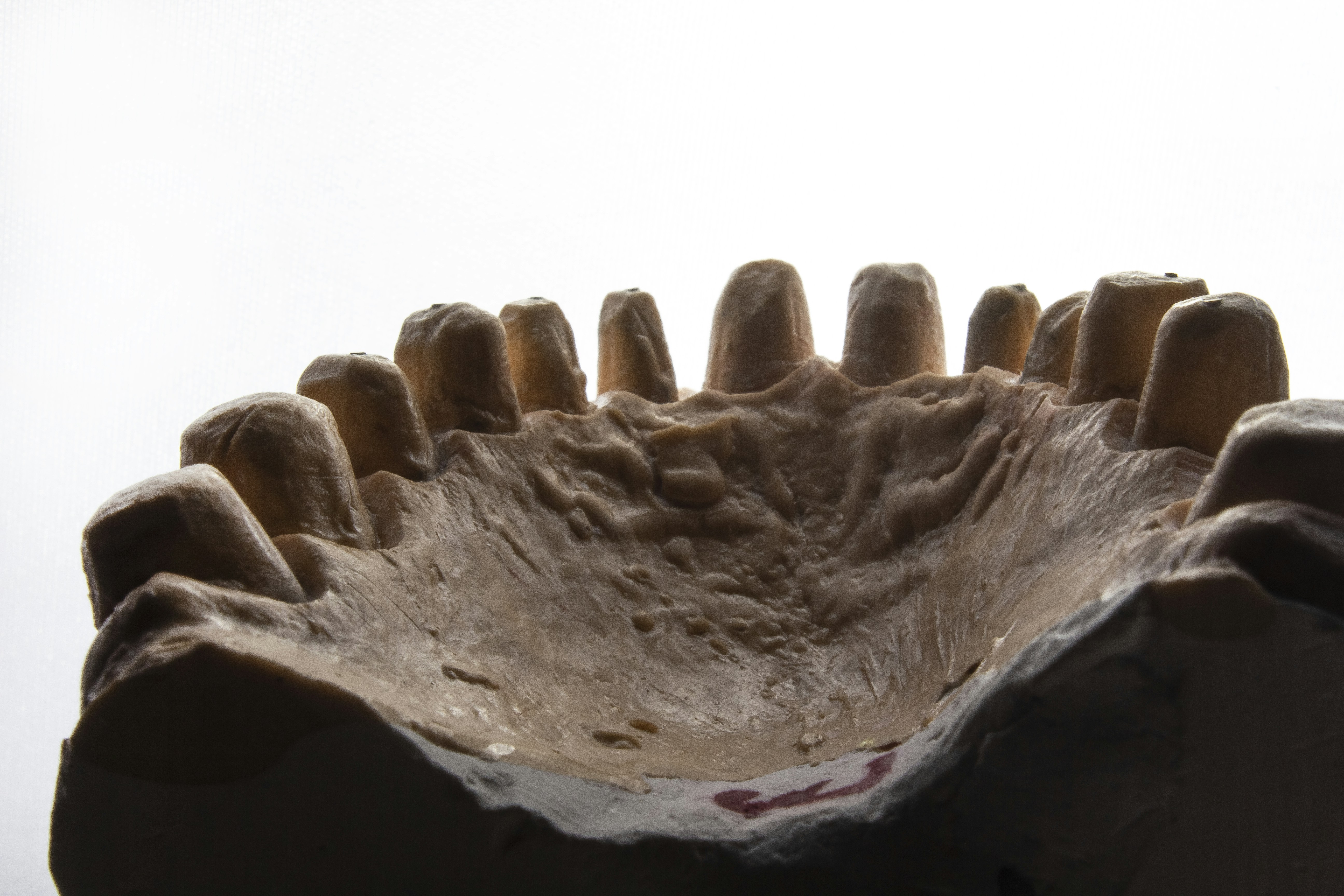 Photo by dentistozkanguner