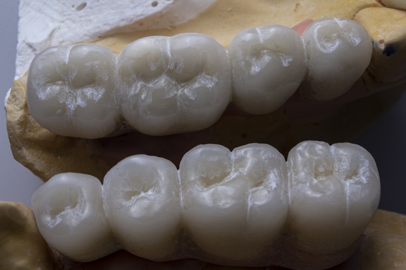 Close-up of a dental technician carefully crafting a porcelain crown under bright workshop lights.