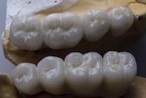 A detailed view of dental crowns or bridges placed on a dental mold, displaying the intricate grooves and textures of the artificial teeth.