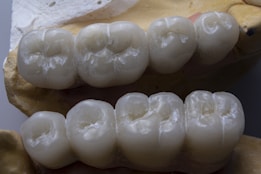A detailed view of dental crowns or bridges placed on a dental mold, displaying the intricate grooves and textures of the artificial teeth.