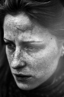 A close-up black and white portrait of a person with freckles, expressing a contemplative or pensive mood. The image highlights texture and emotion through the use of shadows and light.