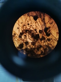 A close-up view through a microscope revealing intertwined strands and dark, round shapes against a light brown background. The image contains intricate patterns and textures, typical of a microscopic biological sample.