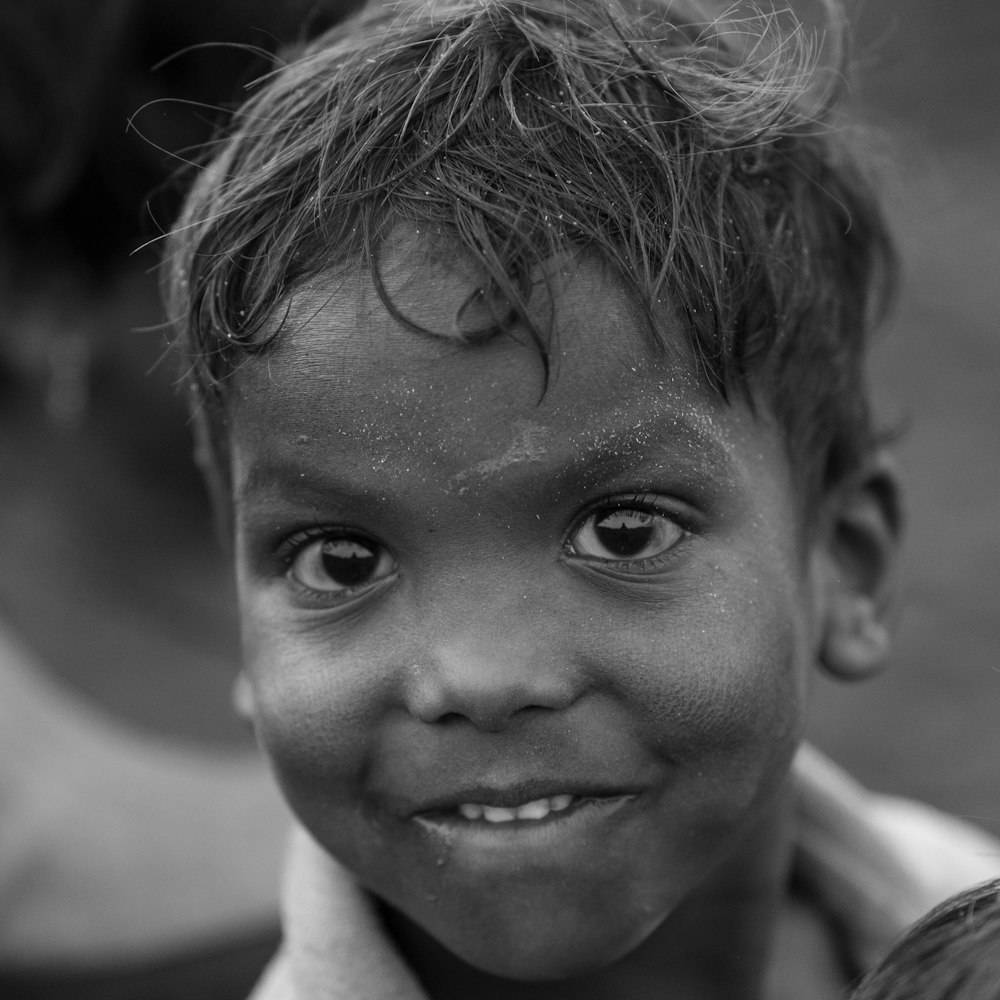 a boy with a small face