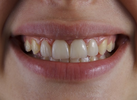 a close-up of a person's mouth