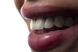 a close-up of a person's mouth with teeth showing