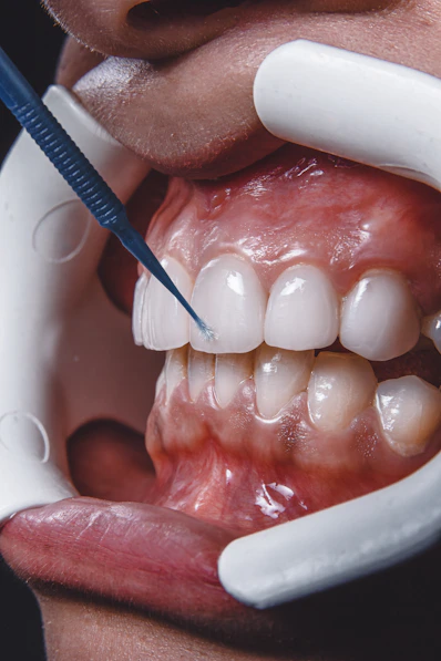 Close-up of mouth showing gums