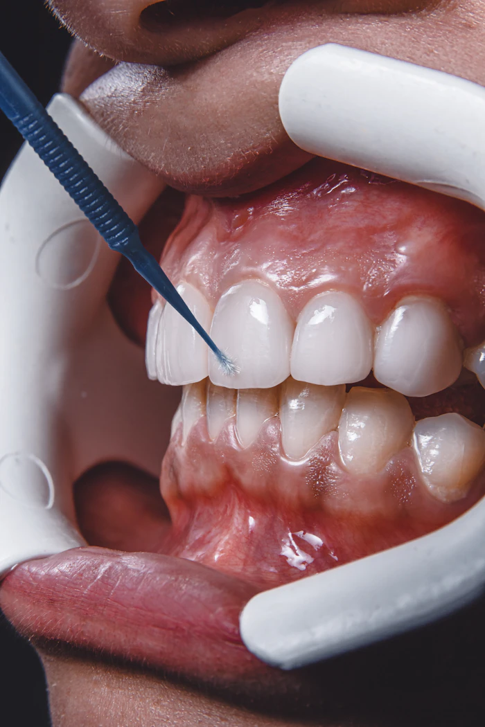 Próteses Dentárias