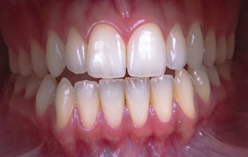 a close up of a person's mouth