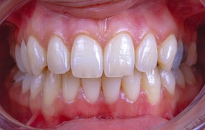 a close-up of a person's mouth