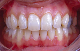 a close-up of a person's mouth