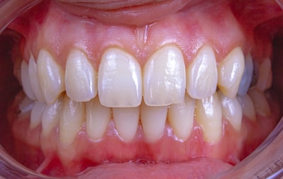 a close-up of a person's mouth