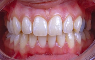 a close-up of a person's mouth