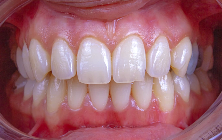 a close-up of a person's mouth