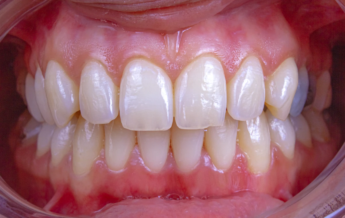 İllüstratif görsel: a close-up of a person's mouth