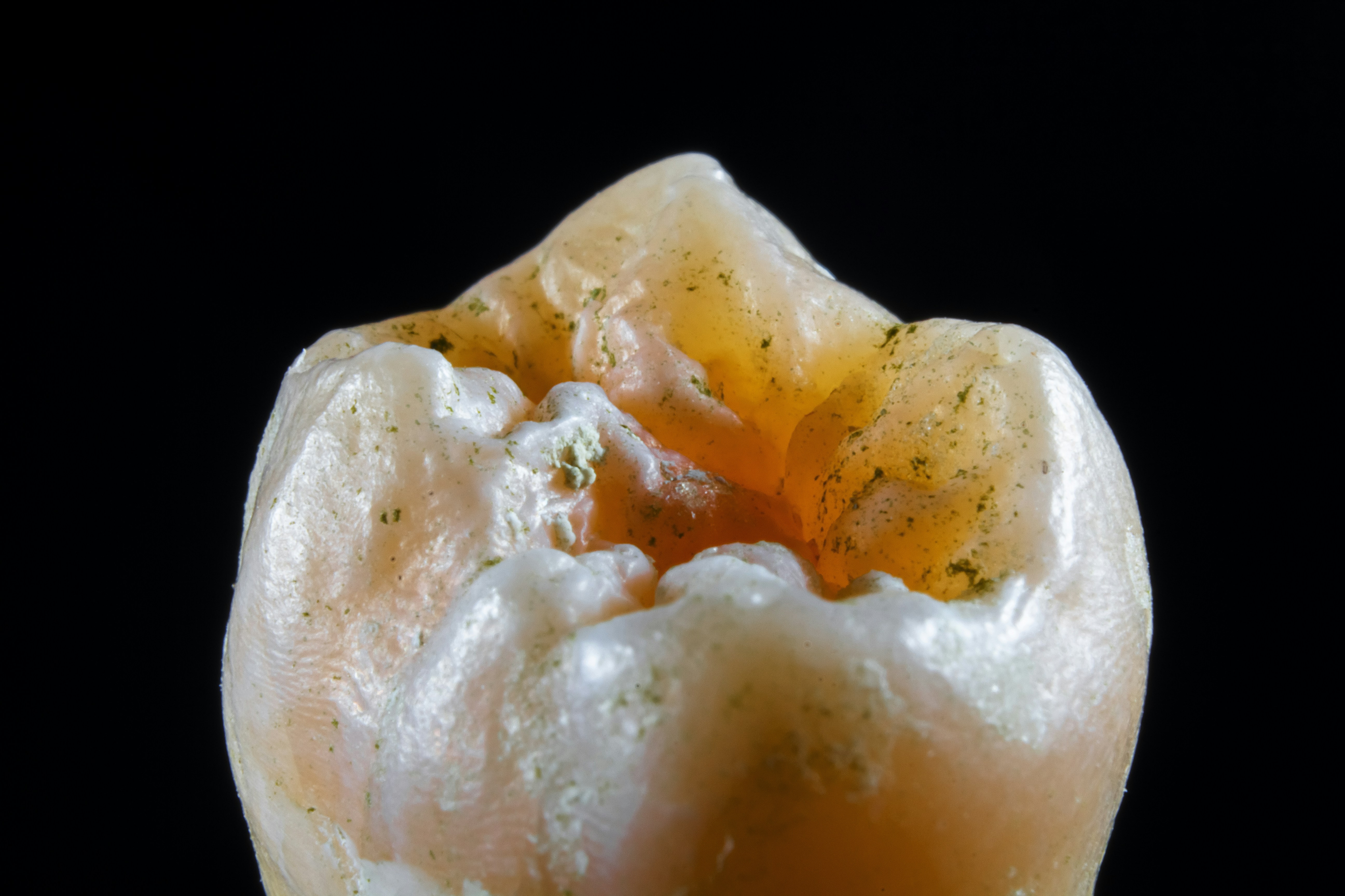 Photo by dentistozkanguner