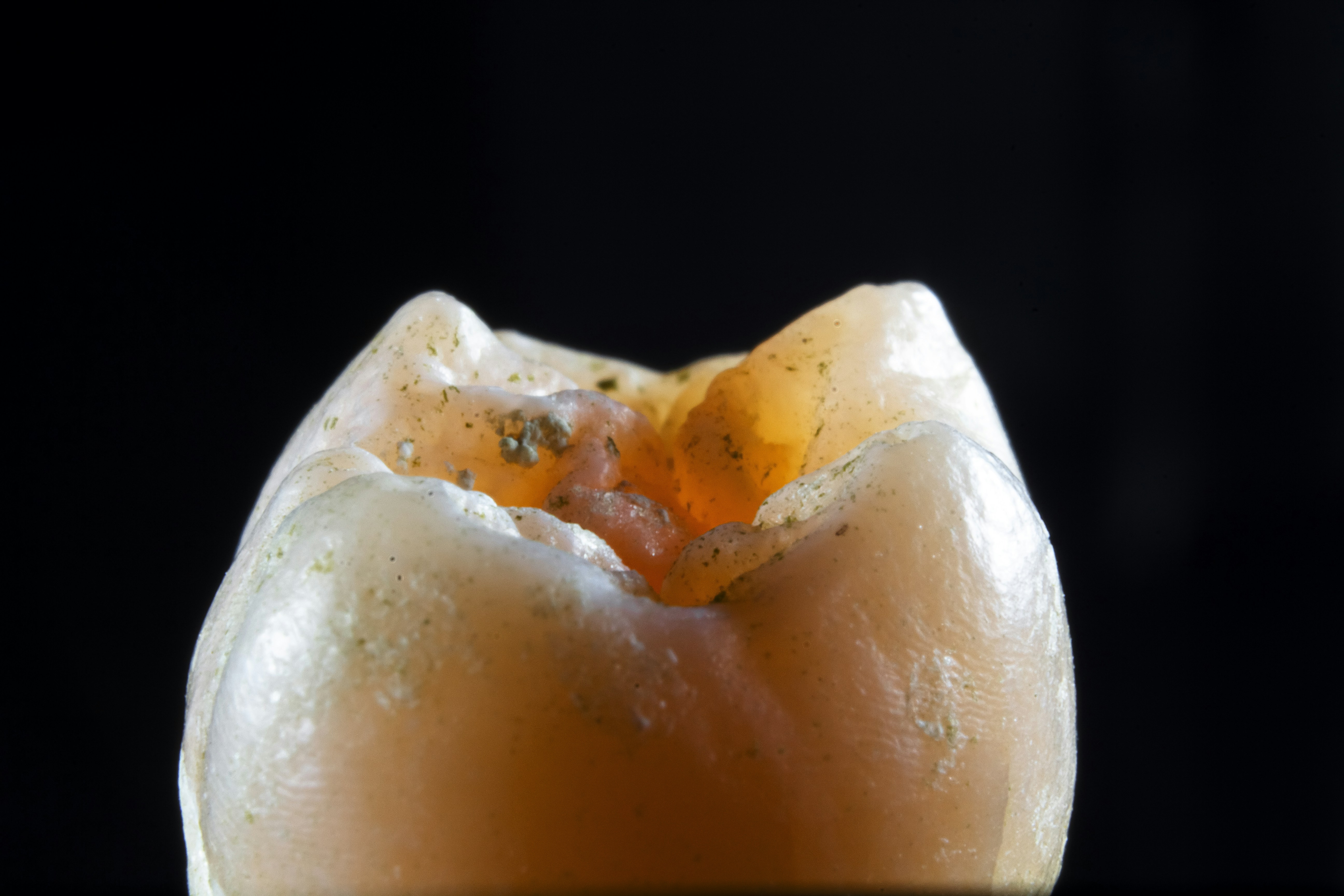 Photo by dentistozkanguner