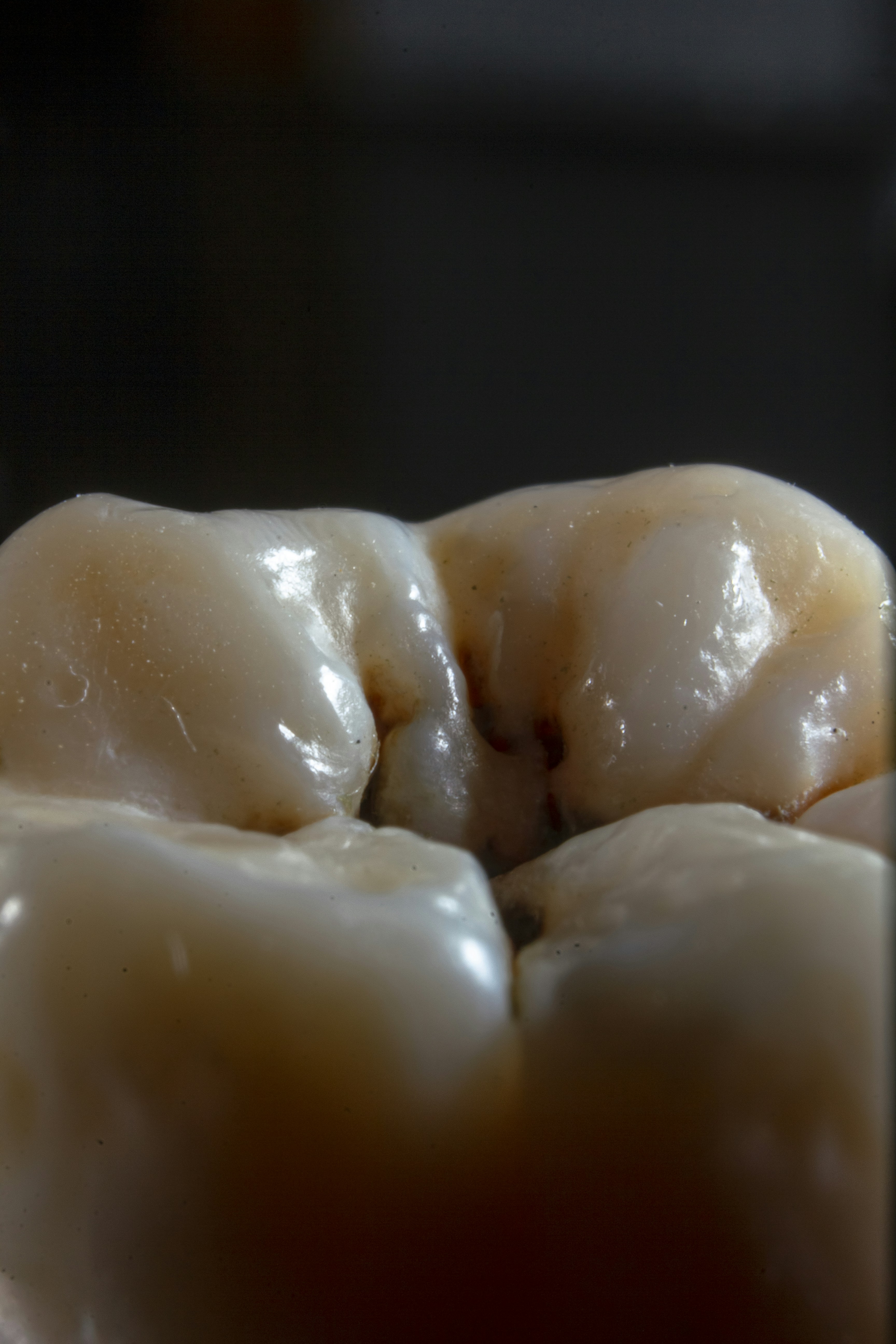 Photo by dentistozkanguner