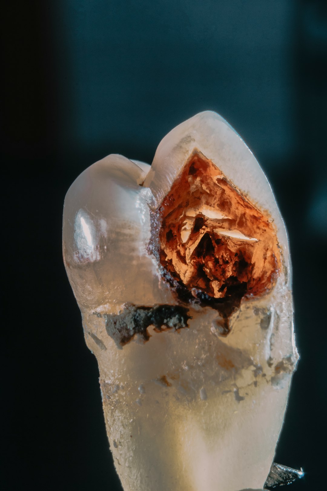 Molarul dental floss