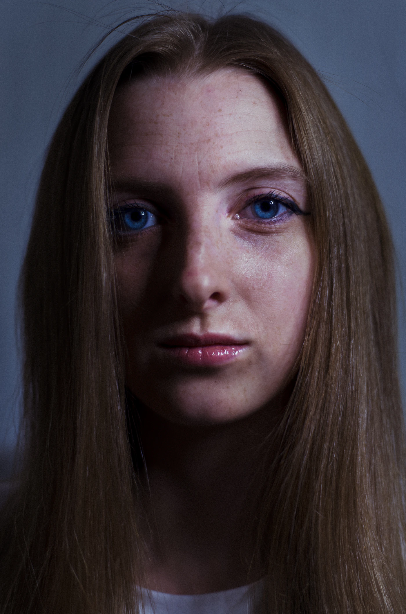 Close-up forehead and brow portrait during botulinum toxin treatment review