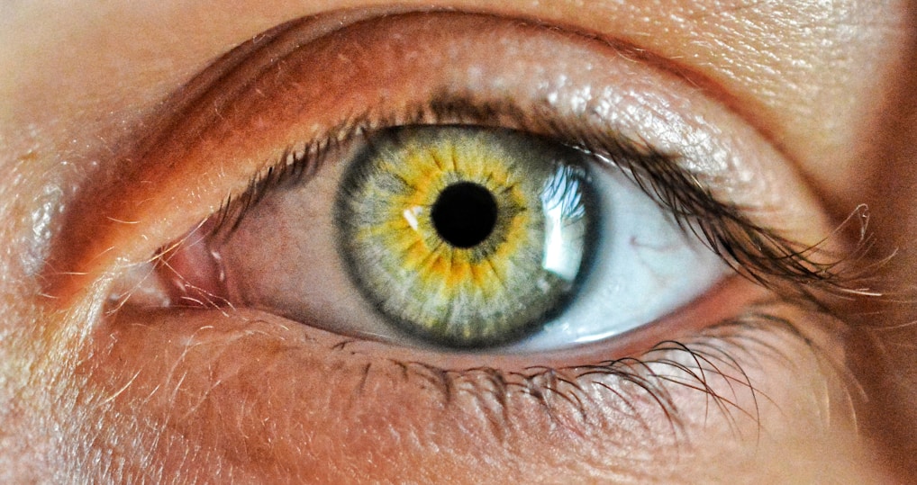 Close-up of an eye showing signs of glaucoma with detailed optic nerve imagery.
