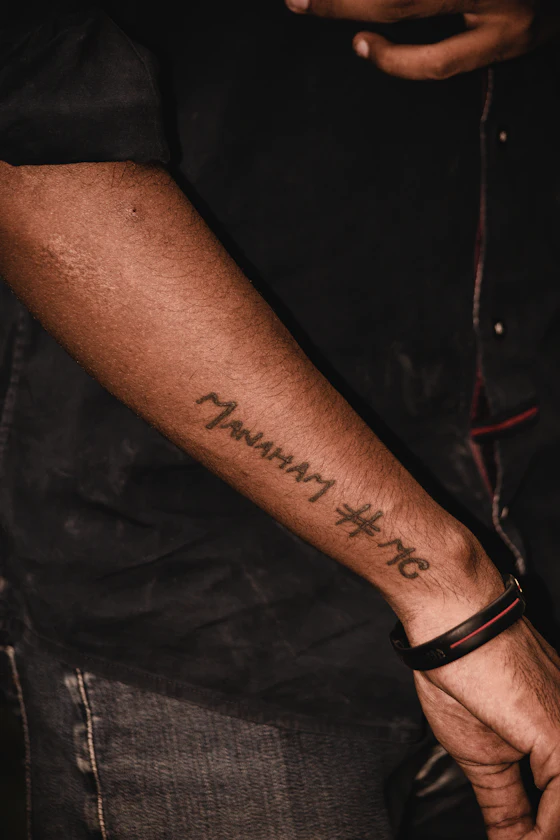 Arm after treatment, ink significantly faded