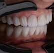 a person's mouth with teeth