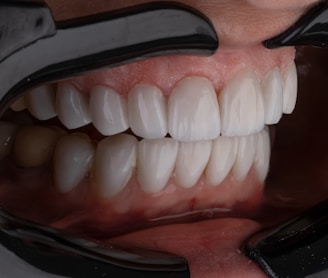a person's mouth with teeth