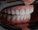 a person's mouth with teeth