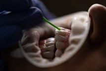 A close-up image of a dental procedure in progress. A dental professional wearing gloves is applying a substance onto the surface of a patient's teeth using a small applicator. The patient's mouth is open, and a dental retractor is being used to keep the lips away from the teeth.