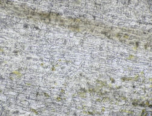 A detailed view of tomato leaf cells illuminated under the microscope, showing intricate structures.
