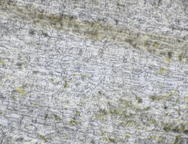 A close-up view of a thin section of a plant leaf under a microscope. The image shows intricate, interlocking cells that form a mosaic pattern, with some slight variations in size and shape. There are also subtle patches of darker and lighter areas, possibly indicating different cell types or structures within the leaf tissue.
